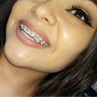 Behel Fashion Increase Teeth