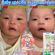 Baby eczema cream15g Baby Itch Relief Cream itchy skin cream krim gatal anti-itch cream,diaper rash,