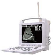 USB & WIFI Portable HandheldNColor Doppler Ultrasound Probe Portable Black and White Ultrasound