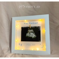 2020012 Frame/frame 3d USG Baby Photo Frame