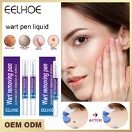 Eelhoe eelhoe Wart Pen Remove Warts Warts Flat eelhoe Warts Warts Liquid eelhoe Warts Cream eelhoe F