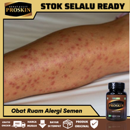 Obat Ruam Alergi Semen Obat Gatal Alergi Semen Obat Gatal Terkenal Semen Obat Alergi Semen Alami Oba