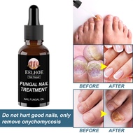 eelhoe nail fungus treatment liquid repair liquid