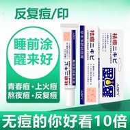 AOPY Herbal Purifying Acne Cream Smoothes and Hydrates AcneAOPY草本净颜祛痘膏平滑补水粉刺闭口痘印水杨酸皮傲宁祛痘膏凝胶8.15