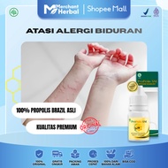 MERAH Medicine for Allergies, Hives, Chronic - Chronic - Hives, Itchy Skin, Rashes & Red Spots, Prop