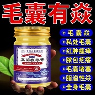 真菌拔毒膏 舒缓皮肤瘙皮肤不适外用乳膏 1瓶