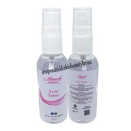 Marwah - Acne Toner