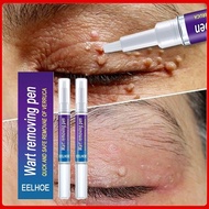 2Pcs Wart Wart Remover Corn Removal Liquid