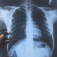 ฟิล์มเอกซเรย์ใช้แล้ว ฟิล์มเอกซเรย์เก่า ฟิล์มเอกซเรย์ ลิ้นแตรลม แผ่นแตร โมแตร ใช้ประดิษฐ์อื่นๆ used x