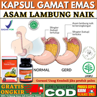 Kapsul Gamat Emas Obat Asam Lambung Naik Maag Kronis Gerd Luka Tukak Lambung Nyeri Ulu Hati Infeksi