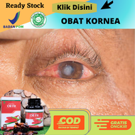 Obat Kornea Mata Mata Kornea Memutih Hilangkan Bintik Putih Di Kornea Mata Berselaput Putih Selaput