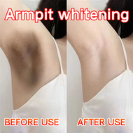 permanent whitening cream for underarm singit pampaputi armpit private part neck whitening for women