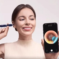 bebird蜂鳥可視掏耳勺高清挖耳勺 bebird 3 Plus D39R