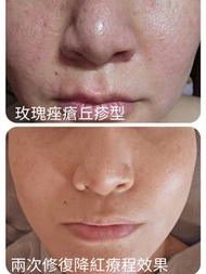 氫水細胞修復美肌療程💆‍♀️