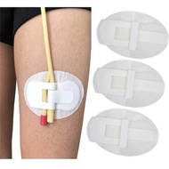 Legband Fixation Stickers PD Catheter Holder Adhesive Patch Stabilization Body Surface Catheter Tube