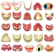 Dental implant model soft gum maxillary sinus implant practice model dental clinic teaching model
