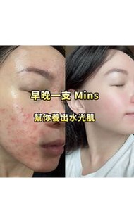 全新升級版Mins2.0🤩🤩🤩全新上市 口罩肌 痘痘肌 暗瘡皮膚 毛孔粗大 修復力強 改善暗啞 改善色素 淡化痘印