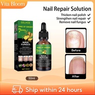 EELHOE Nail Repair Solution 50ml Moisturizing Nail Thickening Gray Nails Repair Onychomycosis Serum 