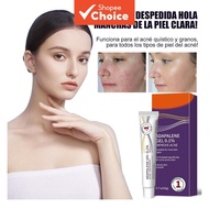 Anti-Acne Adapalene Gel Facial Care Smooths Skin Texture Specially For Acne-Prone