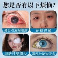 Men Women Hair Dedicated Glasses Protective Dust High-Value Germs Allergies Anti-Flower Eyes Itchy G