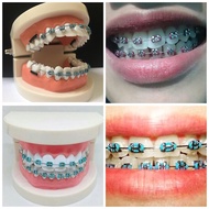 ready  stock READY STOCK BRACES CLICK DESIGN NORMAL VIRAL FAST SHIPPING