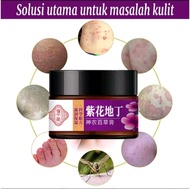 Cream Gatal Cina Ampuh. Cream Jamur. Cream Eksim. Salep Eksim Cina Ampuh. Salep Jamur. Salep Dermati