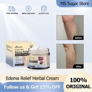 Ximonth Edema Relief Herbal Cream 30g Varicose Vein Treatment Cream Spider Vein Pain Varicosity