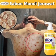 防螨止痒祛痘美白沐浴露