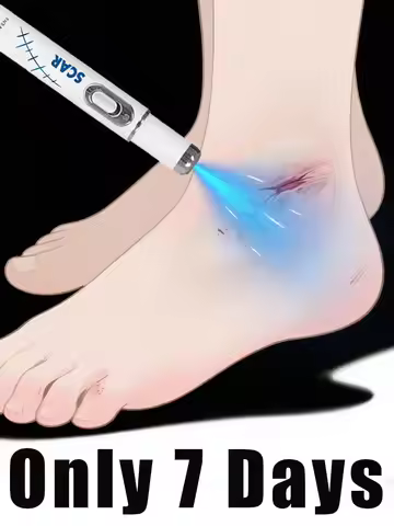 Blue Light Pen Solve Scar, Best-Selling Product in Asia