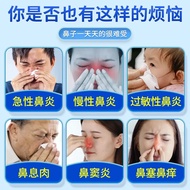 A/🏅Physiological Sea Salt Water Nasal Spray Allergic Rhinitis Sinusitis Nasal Dryness Nasal Itching Nasal Congestion Nas