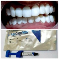RUBY COMPNANO(RUBY DENT) light curing dental composite 4g