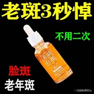 Freckle cream  祛斑霜 【祛斑美白】除斑液斑点黑色素色斑雀斑老年斑晒斑美白祛斑精华液11/12