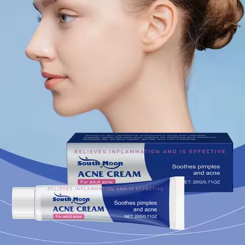 South Moon Herbal Soothing Acne Cream Oil Balance Pore Cleansing Blackhead Reduction Deep Moisture N