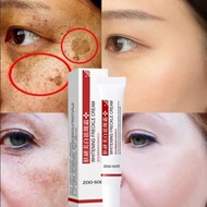 □✥☁  Whitening Freckle Cream Remove Dark Spots Anti Freckle Face Creams Niacinamide Fade Pigmentation Melasma Brighten Skin Care 20g