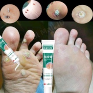 Corn Removal Plaster Remove corns on hands and feet Remove Wart and Callus Skin Tag Remover Corn Rem