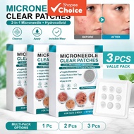 Skin Care Patch with Vitamin E & Salicylic Acid – Clear Pores, Soothe Acne – 9 Patches Tompok Penjag
