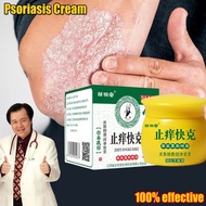 【Buy2Free1&COD】cream gatal kulit antifungal cream krim gatal kulit herba cina eczema cream psoriasis