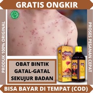 Obat gatal kulit sekujur badan pengobatan / Obat bintik-bintik kulit / Obat gatal alregi / Sirup gat