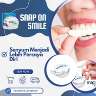 Snap On Smile Gigi Palsu Pengganti Gigi Sementara Snap On Smile