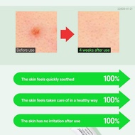 FATION ครีมแก้ปัญหา Nosca9 45มล