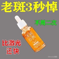 Freckle cream  祛斑霜    【专祛老年斑】  美白祛斑精华液   祛斑点黑色素    强效50到60岁祛斑神器    [Specially remove age spots] Whitening and freckle removing essence, spot removing melanin, powerful freckle removing magic tool for 50 to 60 years old   nn882.sg4.6