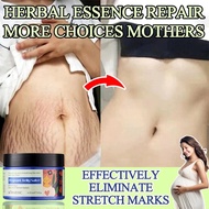 Pregnant women stretch mark cream-pregnancy cream120g stretch mark cream-pregnancy cream Repair skin