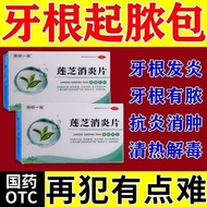 Yuanyan Consistent Lianzhi Anti-Inflammatory Tablets 10 Tablets * 4 Boards/Box Pseudogenic Roots Hav