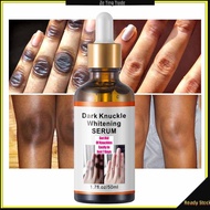 ZeTing Trade: 7 Days Dark Hand Knuckles Elbow And Feet Instant Remover Whitening Serum 50ml Face Ski