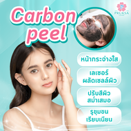 [LAZbeauty] Pruksa Clinic Carbon Peel Program กระตุ้นคอลลาเจน และฟื้นฟูผิว [มูลค่า 3500 บาท]