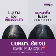 [E-Voucher] APEX เลเซอร์ลดผมร่วง Hair Restart กระตุ้นการเกิดเส้นผมใหม่ ไม่ต้องพักฟื้น ไม่ต้องปลูกผม 