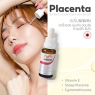 Rebirth - เซรั่มรกแกะเข้มข้น 25 ml. - REBIRTH PLACENTA EXTRACT CONCENTRATE SERUM (25ML)