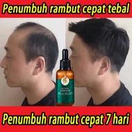 Penumbuh Rambut Botak penumbuh rambut botak pria wanita secara cepat