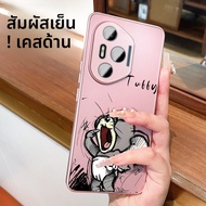 SHUXIE | เคสโทรศัพท์ช่วยระบายความร้อนสำหรับ Honor 300pro 400 200 100pro