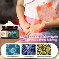 Ubat Gatal Kemaluan cream gatal kulit Psoriasis Antifungal Cream quickly relieve Eczema Itchy Peelin